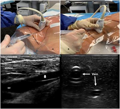 Point-of-Care Ultrasound in the Pediatric Intensive Care Unit